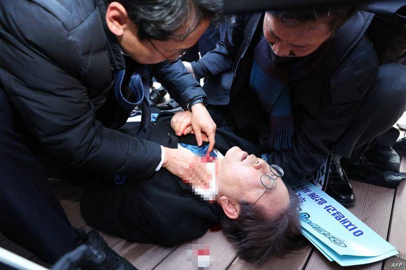 زعيم المعارضة في كوريا الجنوبية في العناية المركزة بعد حادث طعن ودعوات بتشديد الأمن