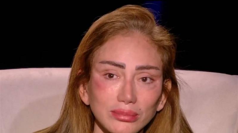 ريهام سعيد تتهم طبيب تجميل 