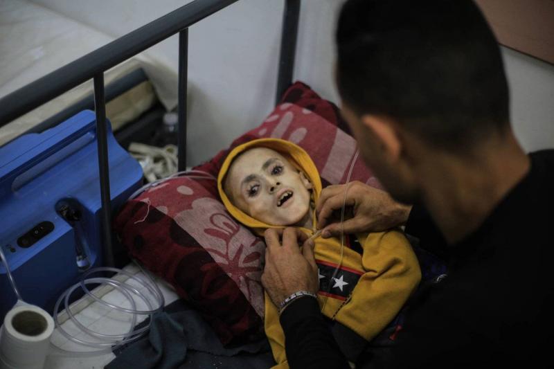 يزن طفل فلسطيني توفي بسبب المجاعة وسوء التغذية