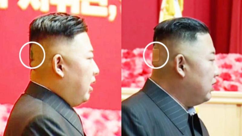 ظهور بقعة غامضة في رأس زعيم كوريا الشمالية