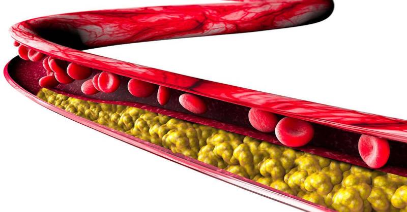 أفضل مصادر دهون لخفض نسبة الكولسترول الضار  في الدم