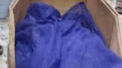 كلاب نهشتها أم خال اغتصبها؟.. طفلة النجف تشغل العراقيين