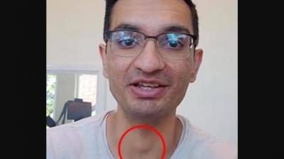 صدمة على تيك توك.. اكتشف إصابته بالسرطان من مشهد