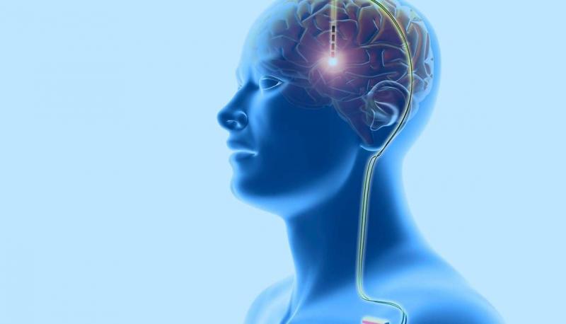 التحفيز العميق للدماغ غير الجراحي يحمل وعداً للإدمان والاكتئاب والوسواس القهري