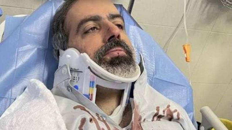 زوجته نشرت صورته ملطخا بالدماء.. إصابة فنان كويتي بحادث